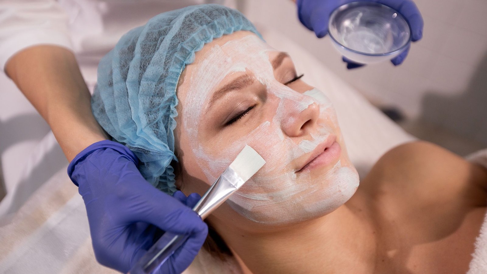 5e4ea3c859528a6b3468872e-pre-peeling-na-harmonizacao-facial