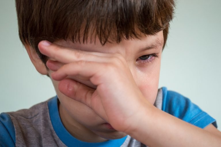 conjuntivite-em-crianca-1