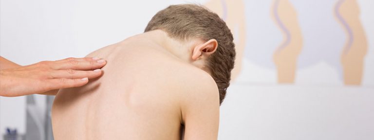 escoliose-na-crianca-2-1