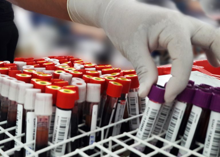 exames laboratoriais 02 imprensa