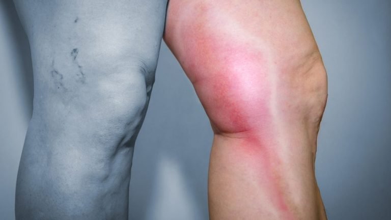 Depositphotos_109398150_s-2019-e1617223399619