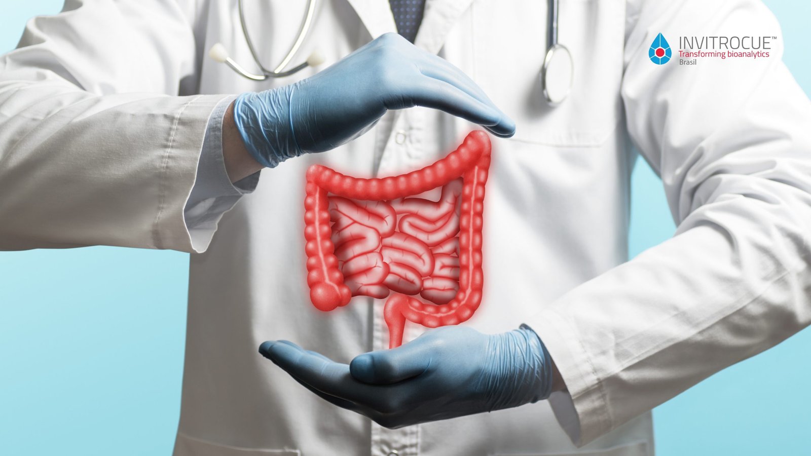 Câncer de intestino: tratamentos personalizados são um avanço da medicina de precisão 1 cancer-intestino-invitrocue-brasil