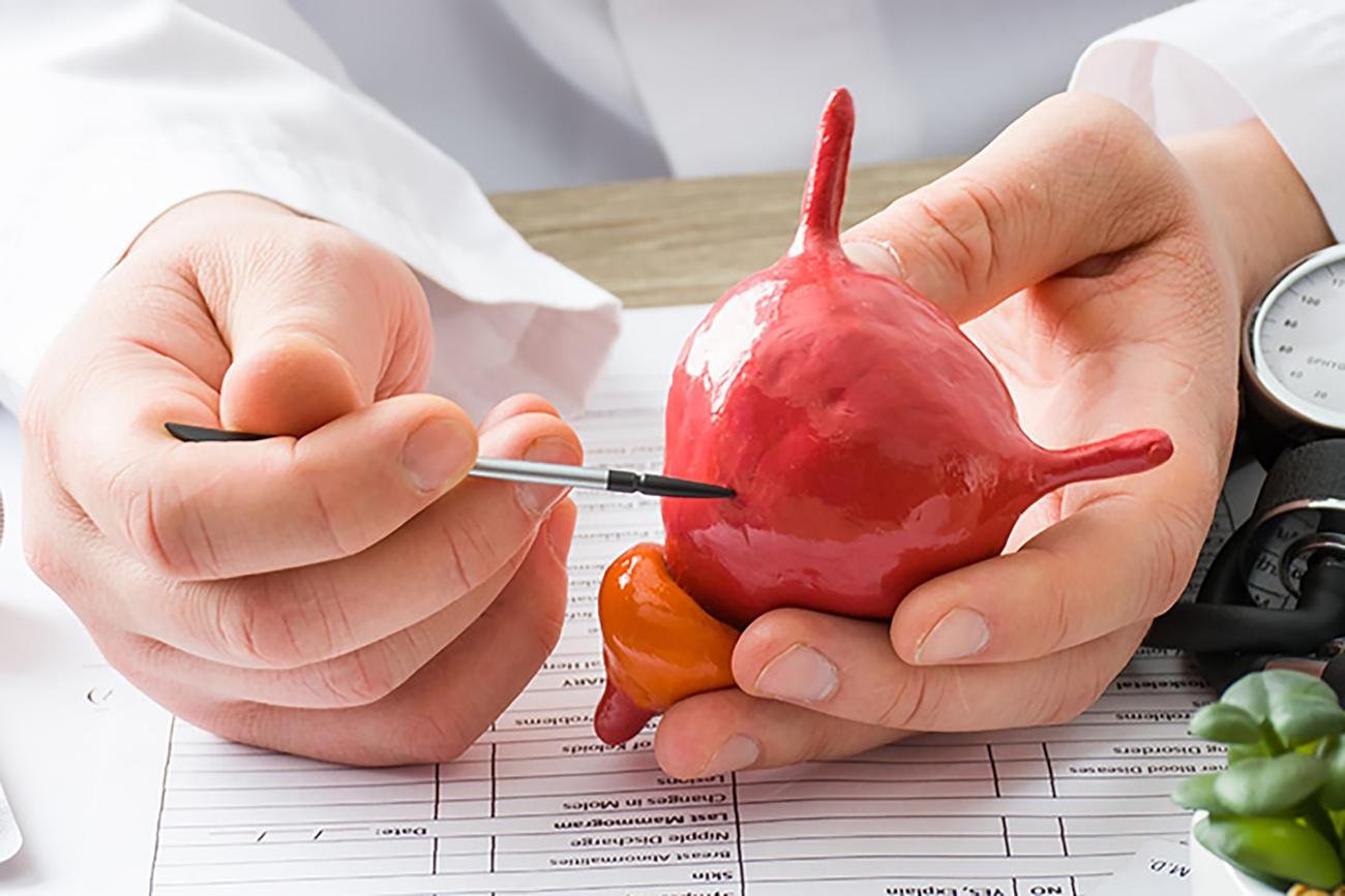 At doctors appointment physician shows to patient shape of urine