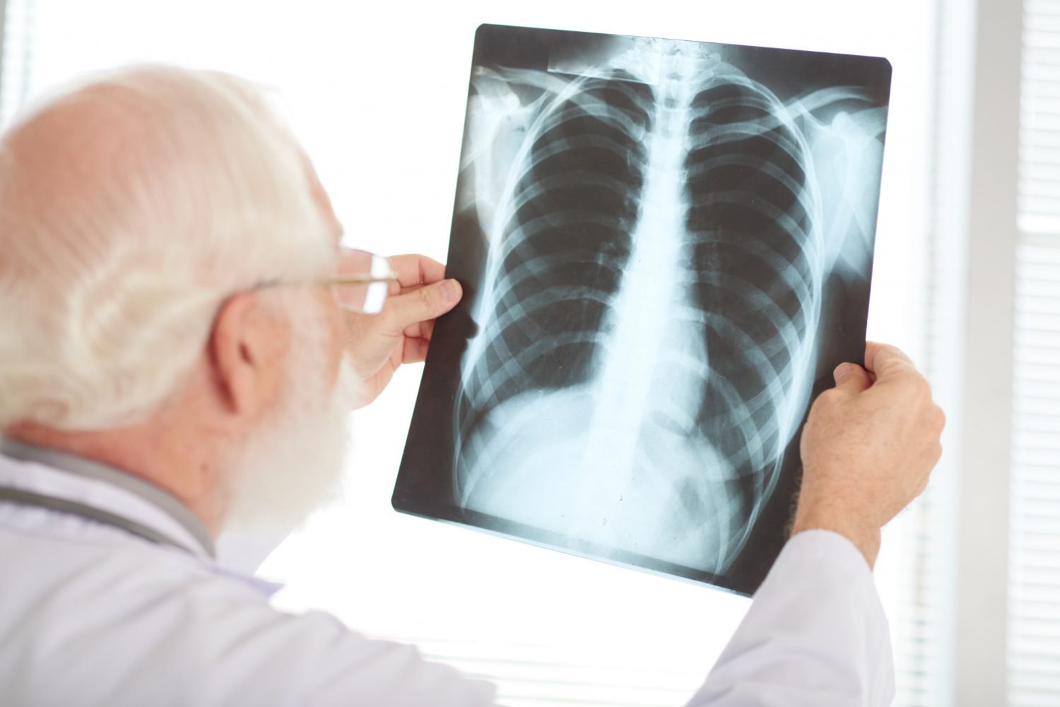 checking-x-ray