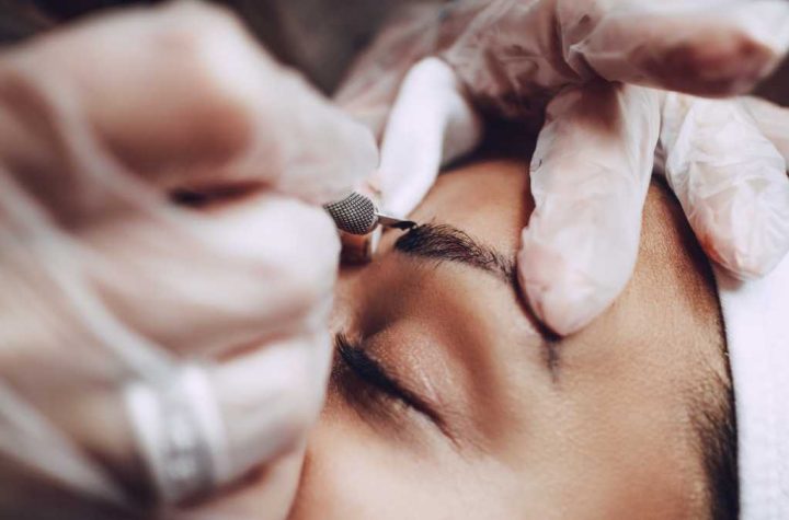 Como Funciona um Transplante de Sobrancelha e Para Quem É Indicado