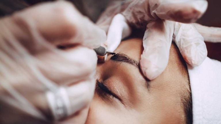 Como Funciona um Transplante de Sobrancelha e Para Quem É Indicado